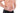 How To Prevent A Hernia In Weightlifting